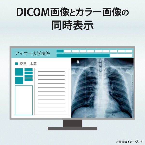 PCモニター 2MP医用画像参照用「MediCrysta」 ブラック LCD-MD241D