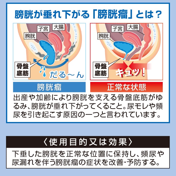 モレナレディ 2枚組 尿漏れ 対策 骨盤底筋 グッズ 膀胱引き締め 骨盤底筋ベルト 送料無料(L): Liveit トップページ｜JRE MALL